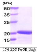 Human Stathmin 1 protein, His tag. GTX67517-pro