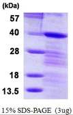 Human LASP1 protein, His tag. GTX67518-pro
