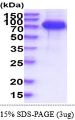 Human SLP76 protein, His tag. GTX67519-pro