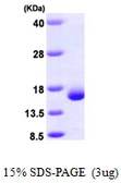 Human Galectin 2 protein, His tag. GTX67521-pro