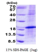 Human LMO1 protein, His tag. GTX67523-pro