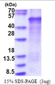 Human LMX1B protein, His tag. GTX67524-pro