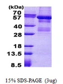 Human LYN protein, His tag. GTX67526-pro