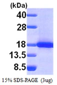 Human SH2D1A protein, His tag. GTX67527-pro