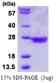 Human MAD2L1 protein, His tag. GTX67528-pro