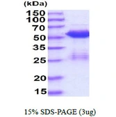 Human SMAD3 protein, His tag. GTX67530-pro
