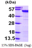 Human MAGEA4 protein, His tag. GTX67534-pro