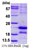 Human MAGEA5 protein, His tag. GTX67535-pro