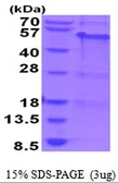 Human MAGEA8 protein, His tag. GTX67537-pro