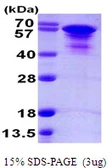 Human Tau protein, His tag. GTX67540-pro