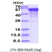 Human Tau protein, His tag. GTX67541-pro