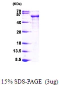 Human Tau protein, His tag. GTX67542-pro