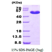 Human MAT1A protein, His tag. GTX67543-pro