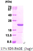 Human MAX protein, His tag. GTX67545-pro