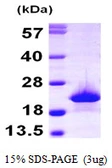 Human Myoglobin protein, His tag. GTX67546-pro