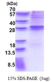 Human EVI1 protein, His tag. GTX67549-pro