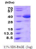 Human MIF protein, His tag. GTX67554-pro