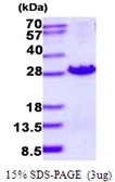 Human MOCS2 protein, His tag. GTX67558-pro