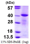 Human MPI protein, His tag. GTX67560-pro