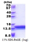 Human MTCP1 protein, His tag. GTX67563-pro