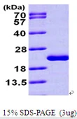 Human MTH1 protein, His tag. GTX67564-pro