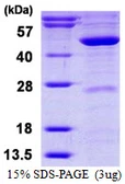 Human MVD protein, His tag. GTX67565-pro