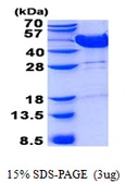 Human MVK protein, His tag. GTX67566-pro