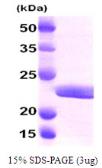 Human Myosin Light Chain 2 (MLC-2v) protein, His tag. GTX67569-pro