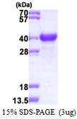 Human NACA1 protein, His tag. GTX67574-pro