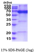 Human NARS protein, His tag. GTX67576-pro