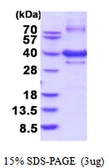 Human NUBP1 protein, His tag. GTX67577-pro