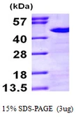 Human NCK1 protein, His tag. GTX67579-pro