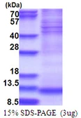 Human NDUFA4 protein, His tag. GTX67581-pro