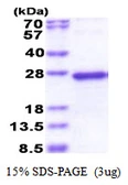 Human NDUFS5 protein, His tag. GTX67584-pro