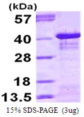 Human IKB alpha protein, His tag. GTX67588-pro