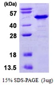 Human IKB beta protein, His tag. GTX67589-pro