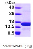 Human NHP2L1 protein, His tag. GTX67592-pro