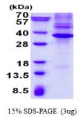 Human Nkx3.1 protein, His tag. GTX67593-pro