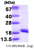 Human nm23-H1 protein. GTX67594-pro