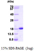 Human nm23-H2 protein. GTX67595-pro