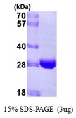 Human NQO2 protein, His tag. GTX67596-pro