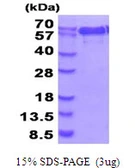 Human NMT1 protein, His tag. GTX67597-pro