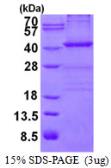Human Nucleophosmin protein, His tag. GTX67599-pro
