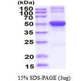 Human ODC protein, His tag. GTX67603-pro