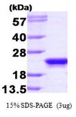 Human RKIP protein. GTX67607-pro