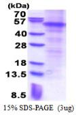 Human Parkin protein, His tag. GTX67612-pro