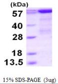 Human PCK1 protein, His tag. GTX67616-pro
