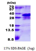 Human CHMP1A protein, His tag. GTX67619-pro