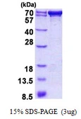 Human PDZK1 protein, His tag. GTX67622-pro