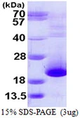 Human Prefoldin 5 protein, His tag. GTX67626-pro
